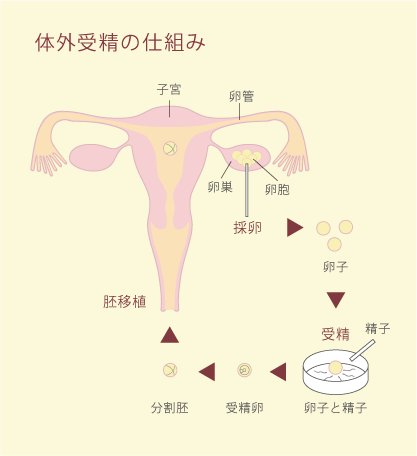 体外受精の仕組み